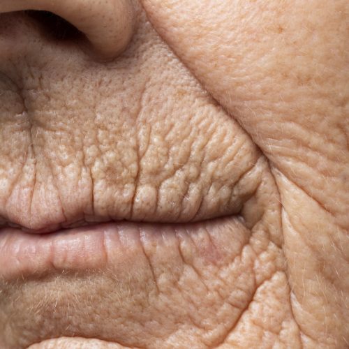 vue-de-face-de-la-texture-de-la-peau-de-la-femme-agee